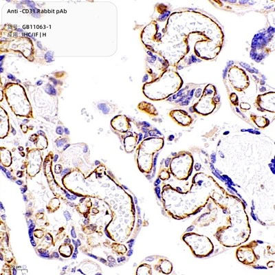 Anti-CD31 konijn PAB